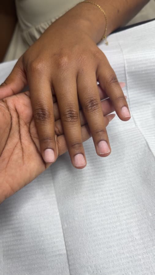 Ongles avant la pose